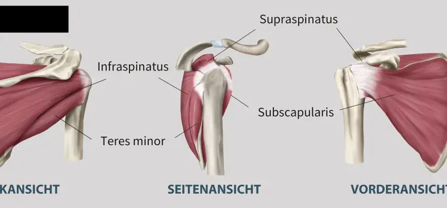 Teres-minor-Schmerzen - Ursachen & effektive Hilfe für die Schulter