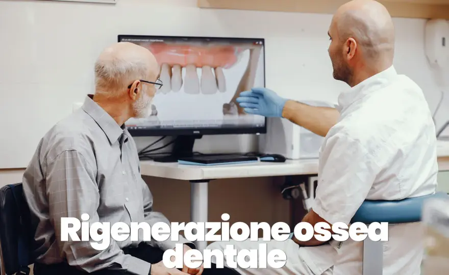Rigenerazione ossea dentale - tecniche, tempi e costi