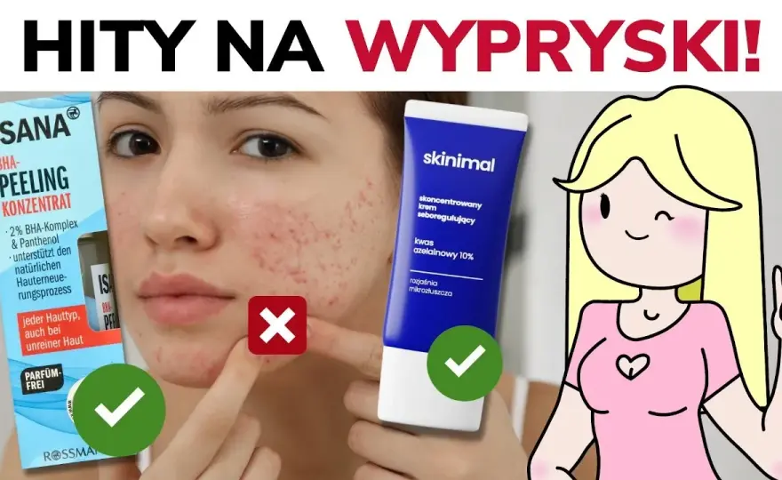 Czym smarować pryszcze? Skuteczne metody, by zniknęły szybko i bez śladu