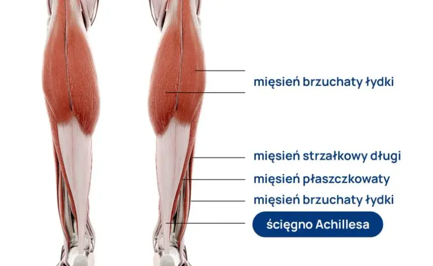 Uczucie miękkich nóg przyczyny – co może prowadzić do osłabienia mięśni?
