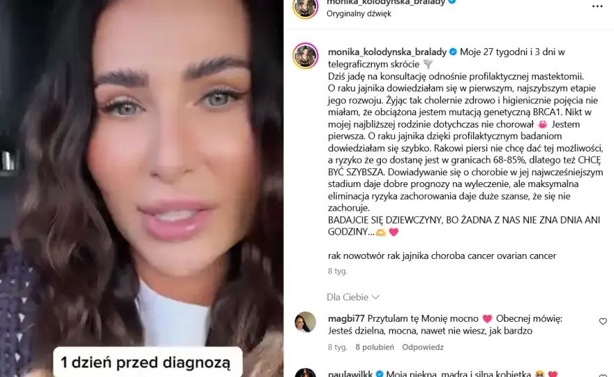 Wczesne objawy raka jajnika, które mogą uratować życie kobietom