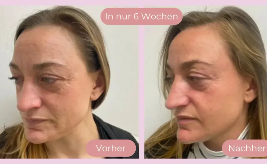 Vitamin C Haut - Vorher-nachher: Was wirklich wirkt & wie!