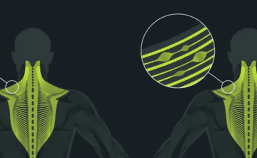 Trigger point en français - traduction et massage