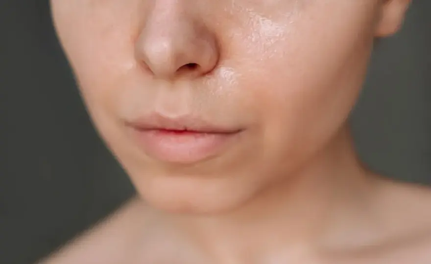 Fettige Haut: Ursachen, Pflege & Tipps für einen matten Teint