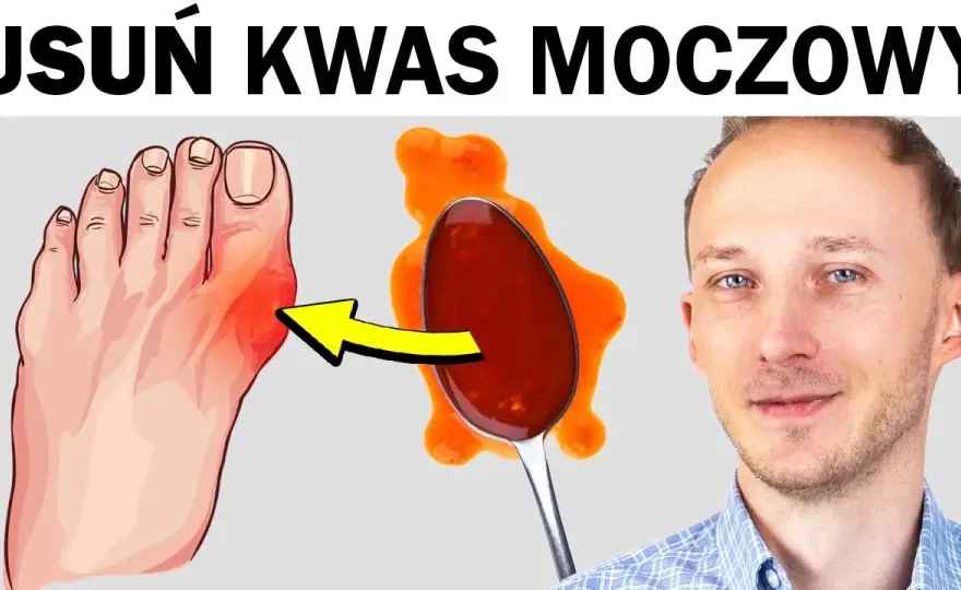 Jak obniżyć kwas moczowy? Sprawdź domowe soki na dnę moczanową