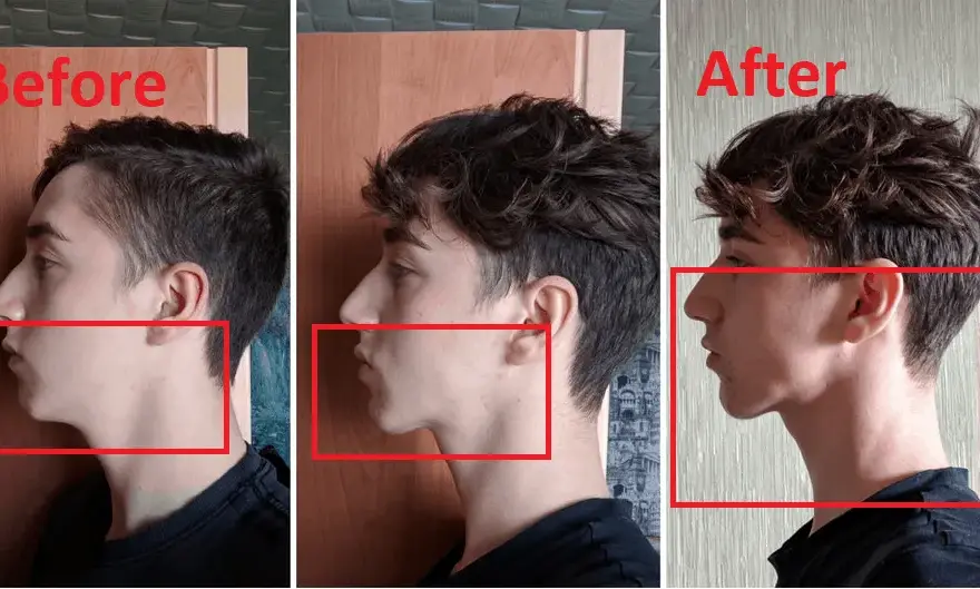 Jak ćwiczyć prawidłową pozycję spoczynkową języka dla zdrowia