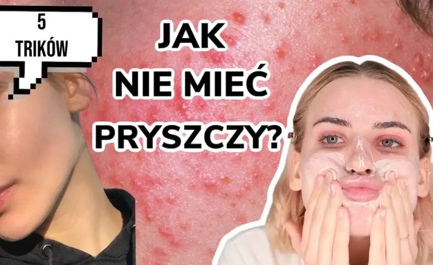 Gładka cera bez pryszczy? Odkryj sekrety eksperta!