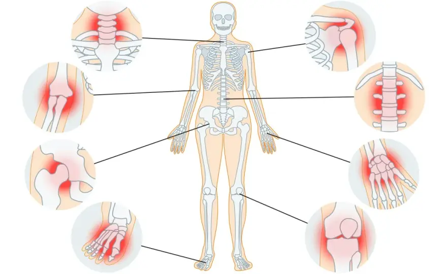 Arthrose heilen ist nicht einfach - was wirklich hilft