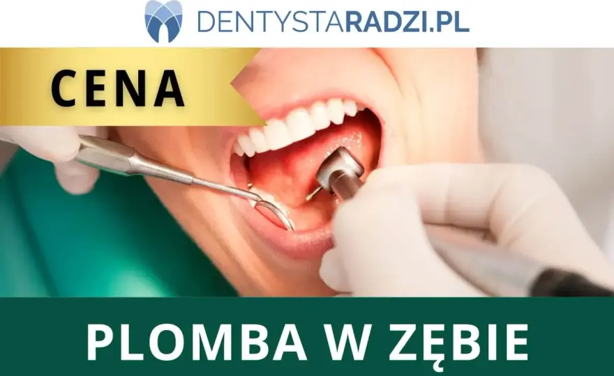 Plomba - Rodzaje, NFZ, jak dbać? Co musisz wiedzieć!
