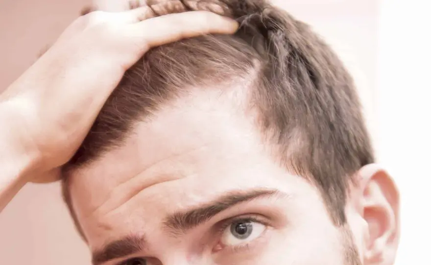 Efluvio telógeno y minoxidil - cuándo merece la pena usarlo