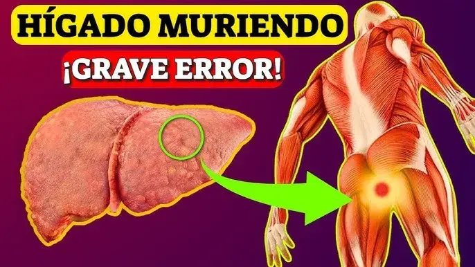 Síntomas hepatitis: ¿Podrías estar ignorando señales graves?