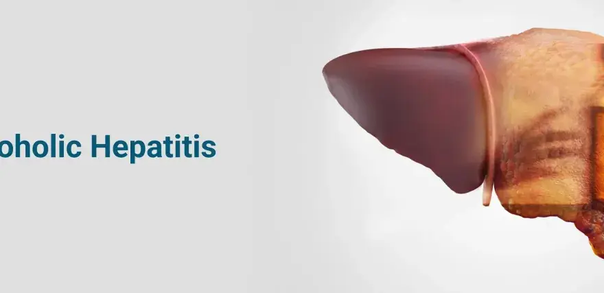 Medicamentos para el hígado alcohólico: ¿realmente protegen tu salud?