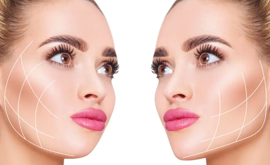 Semaglutida y rostro vacío - Soluciones estéticas reales