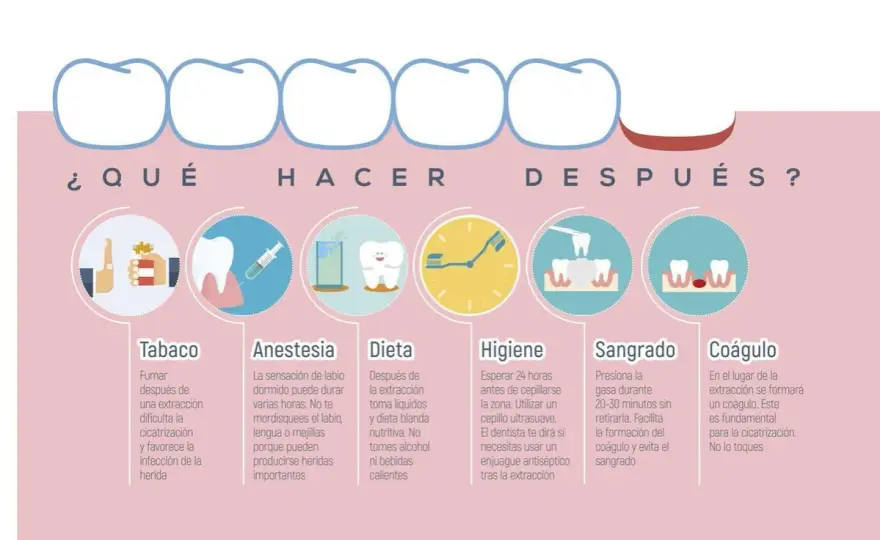 Extracción dental - cuándo se necesita y cómo cuidarse