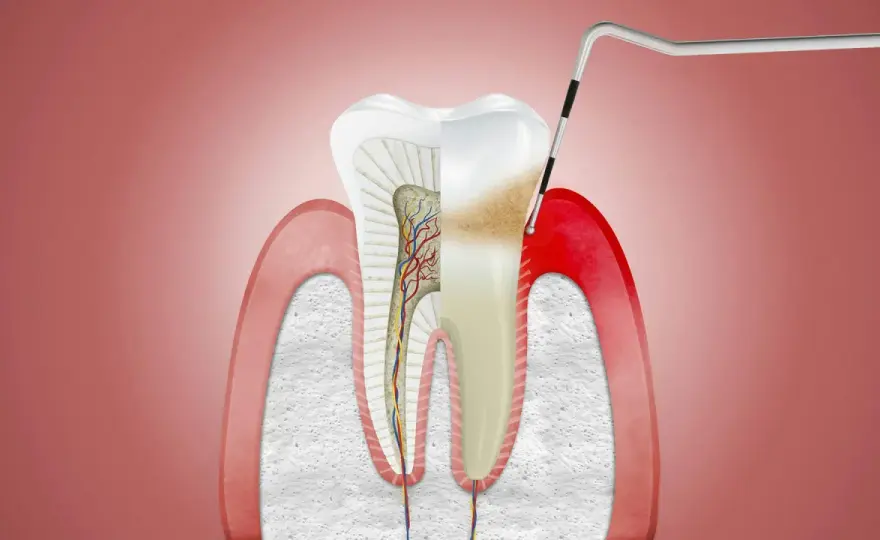 Ból dziąseł - przyczyny, objawy i kiedy do dentysty?