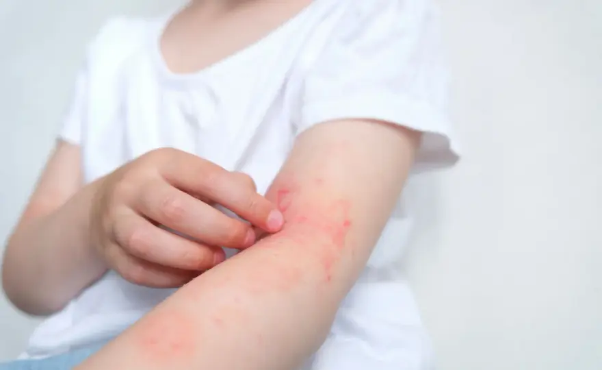 Alergia na psa - Objawy, przyczyny i jak sobie radzić?
