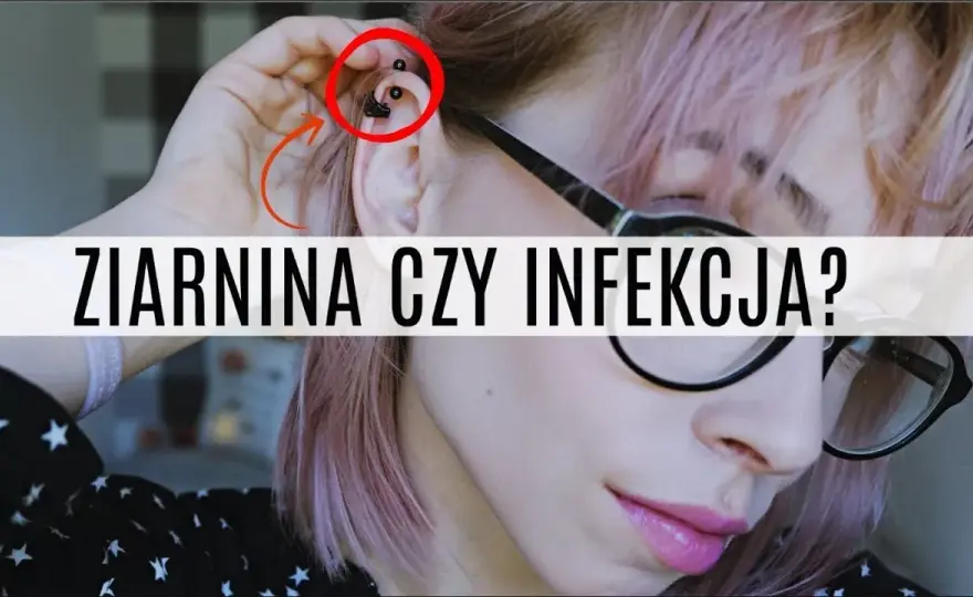 Jak leczyć infekcję po piercingu: skuteczne metody i porady