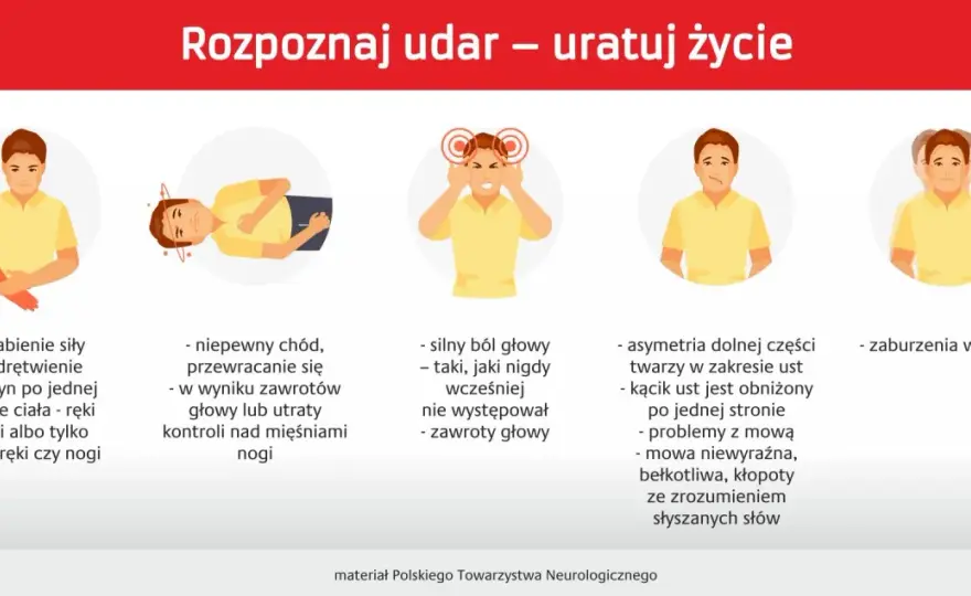 Gdzie pracuje udar mózgu? Poznaj objawy i lokalizację uszkodzeń