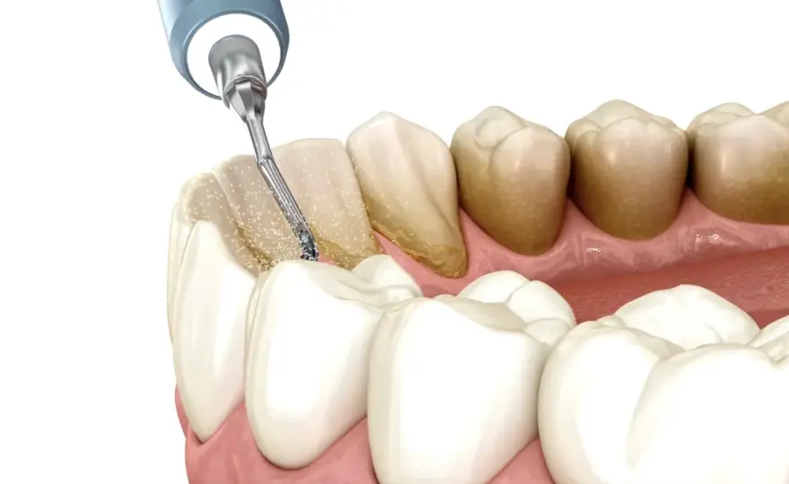 Dentysta: Poznaj pełen zakres pracy, specjalizacje i wpływ na zdrowie
