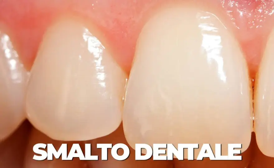 Remineralizzazione denti - Salva il tuo smalto prima che sia tardi!