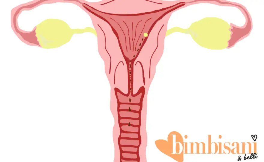 Perdite da impianto - Immagini e come distinguerle dal ciclo