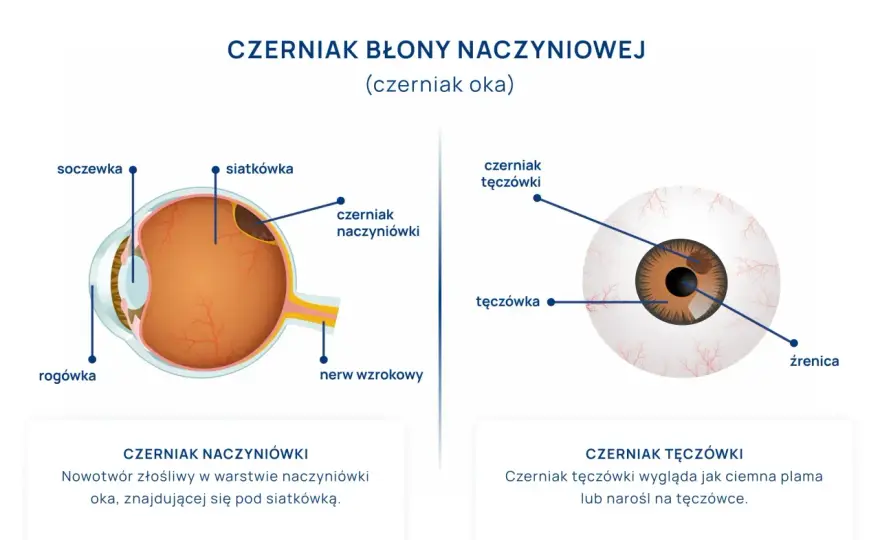 Ból oka - kiedy to sygnał alarmowy?