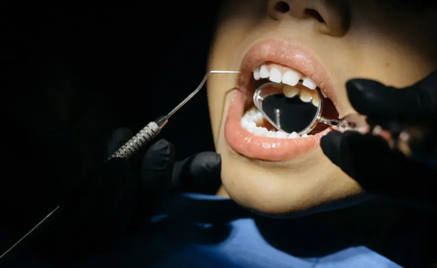 Wypadanie zębów mlecznych - Kiedy do dentysty?