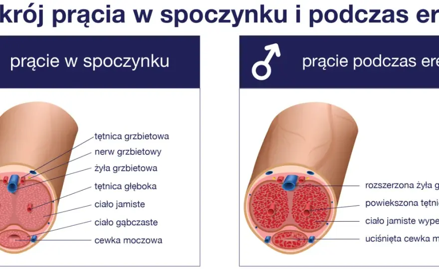 Zaburzenia erekcji - Przyczyny, diagnoza i skuteczne leczenie