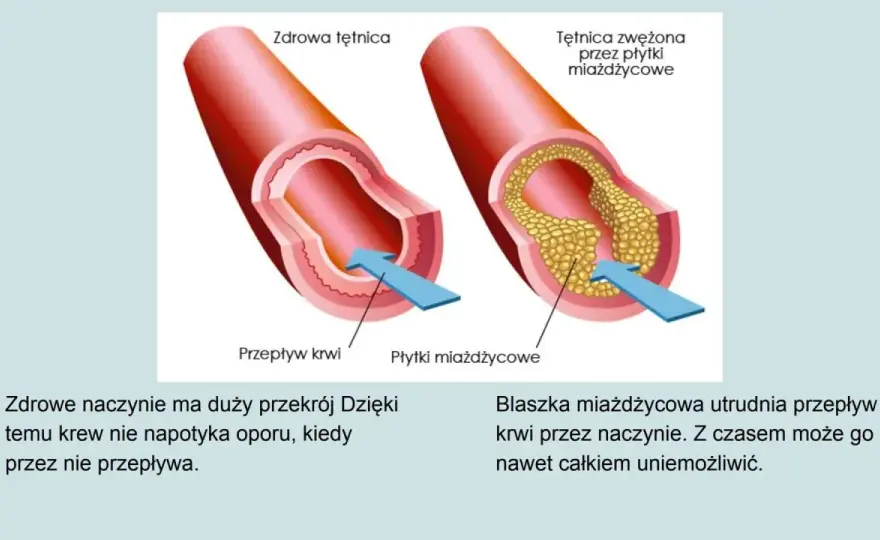 Układ krwionośny - jak działa i jak o niego dbać?