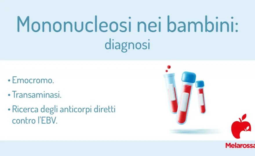 Virus Epstein-Barr nei bambini - sintomi, cure e sport