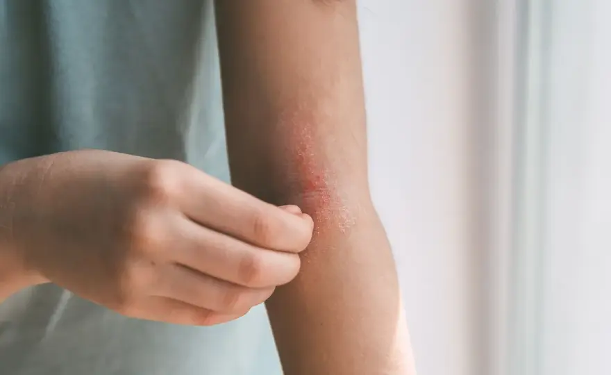 Wizyta u dermatologa - kiedy nie zwlekać i jak się przygotować?