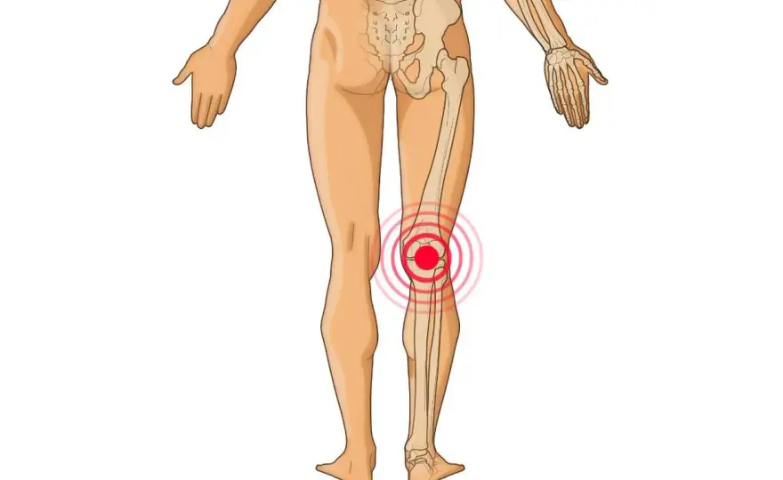 Knie-Sehnen verstehen: Anatomie, Schmerzen & effektive Hilfe