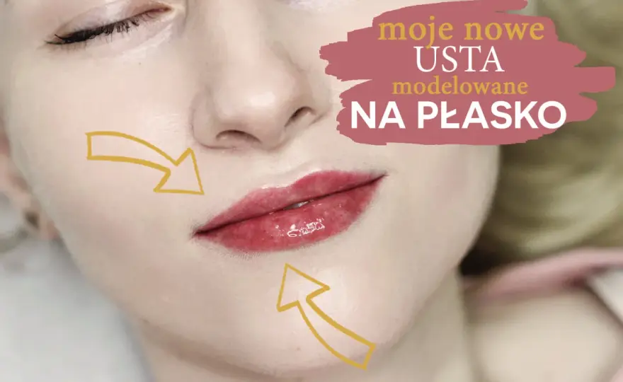 Powiększanie ust 0,5 ml - Czy to naprawdę naturalny efekt?