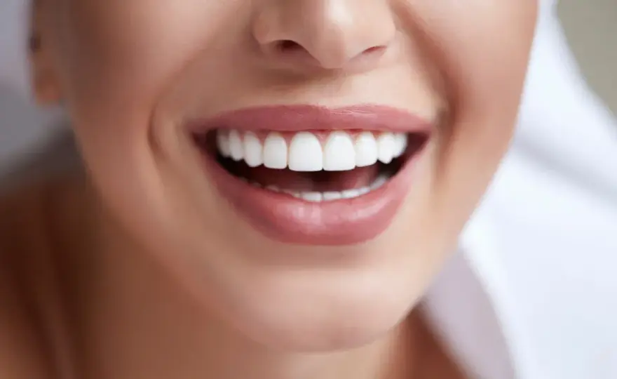 Jak usunąć kamień nazębny bez dentysty - skuteczne domowe metody