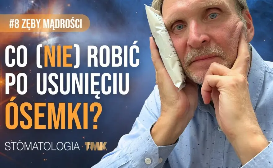 Koszt zdjęcia szwów z dziąsła: 50-150 zł? Czy zawsze płacisz?