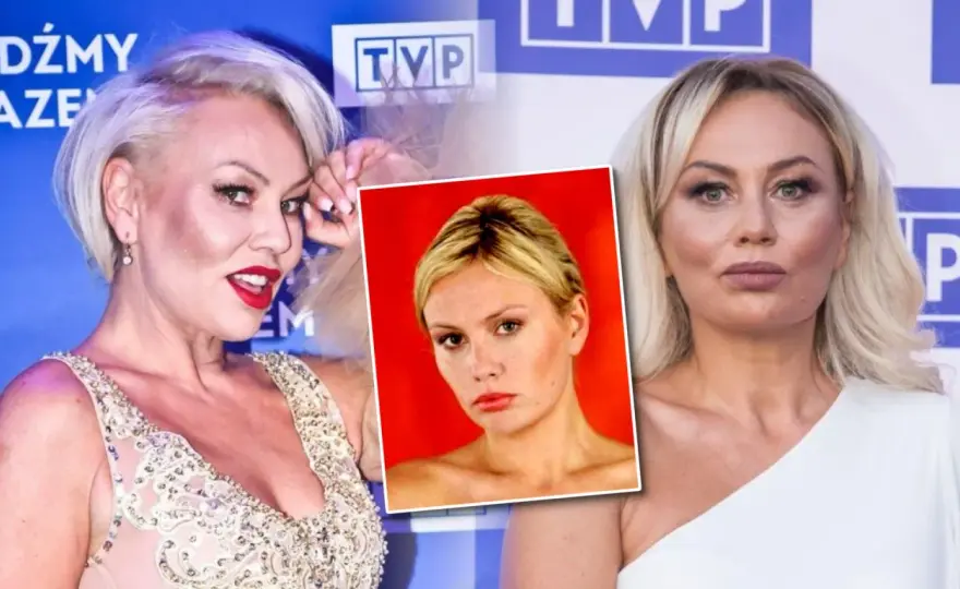 Monika Jarosińska - Operacje plastyczne i mąż - Co jest prawdą?