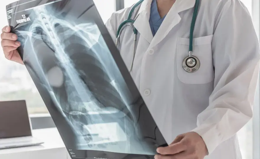 Klatka piersiowa (thorax): budowa, funkcje i narządy w środku