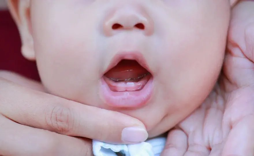 Denti dei bambini, come proteggerli fin dal primo dentino