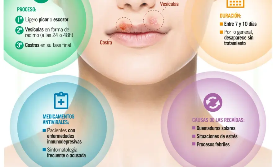 Herpes labial por estrés - síntomas, cuidados y contagio