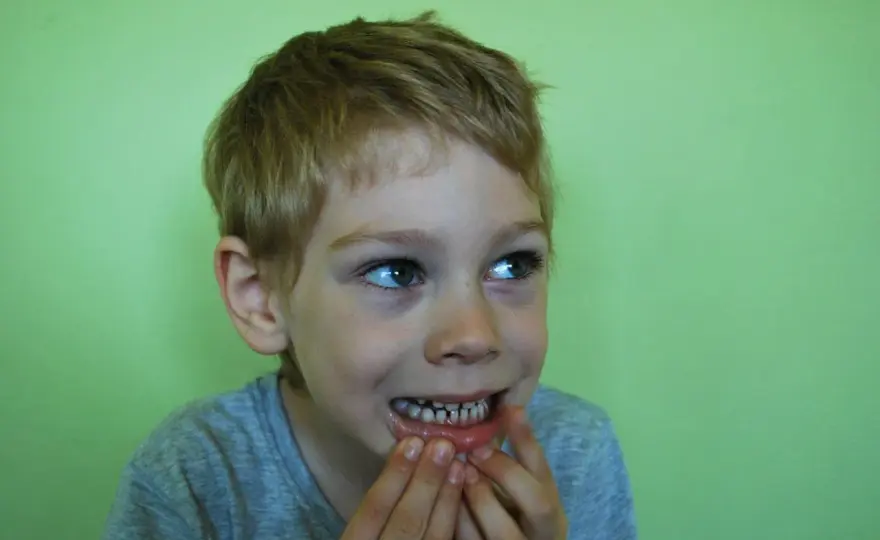 Denti Sensibili - Cosa fare subito e i rimedi che funzionano