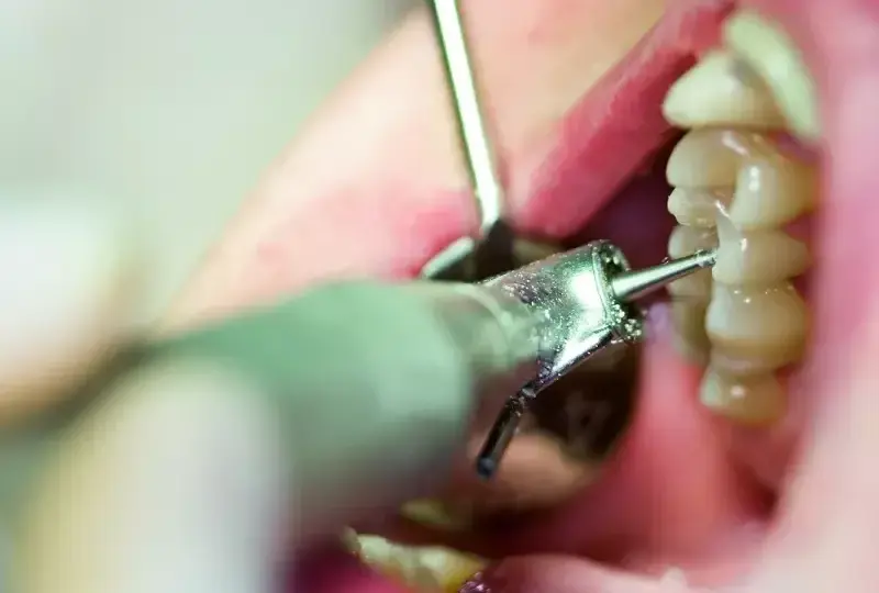 Czy dentysta może odmówić przyjęcia pacjenta z bólem zęba? Oto prawda