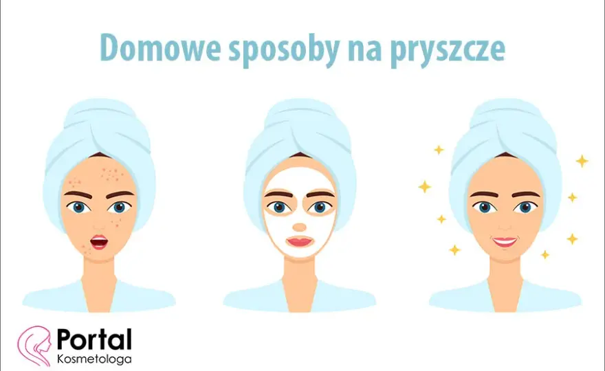 Co jest dobre na pryszcze? Sprawdzone metody i porady eksperta