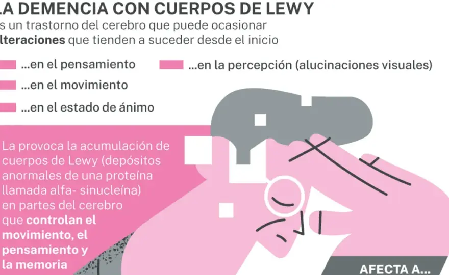 Demencia con Cuerpos de Lewy - Síntomas, diagnóstico y tratamiento