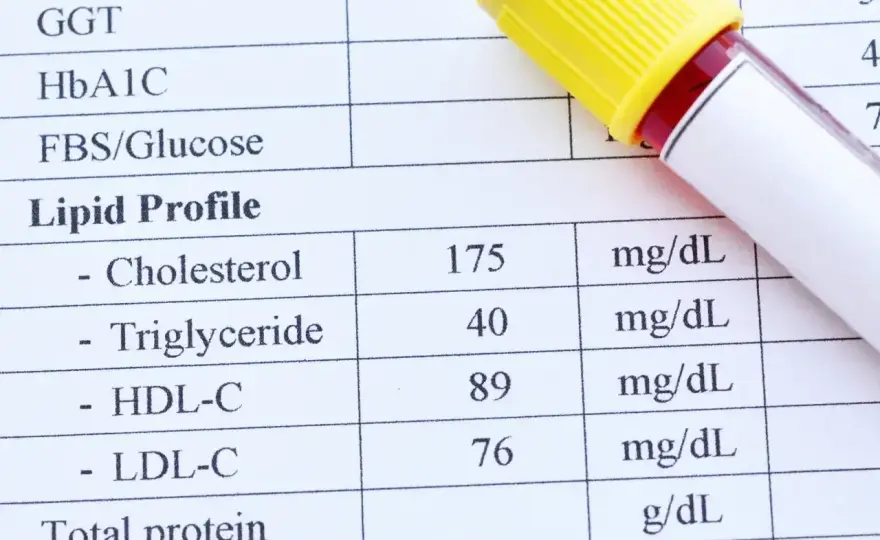 Cholesterol nie-HDL - Co to jest i jak czytać wynik?