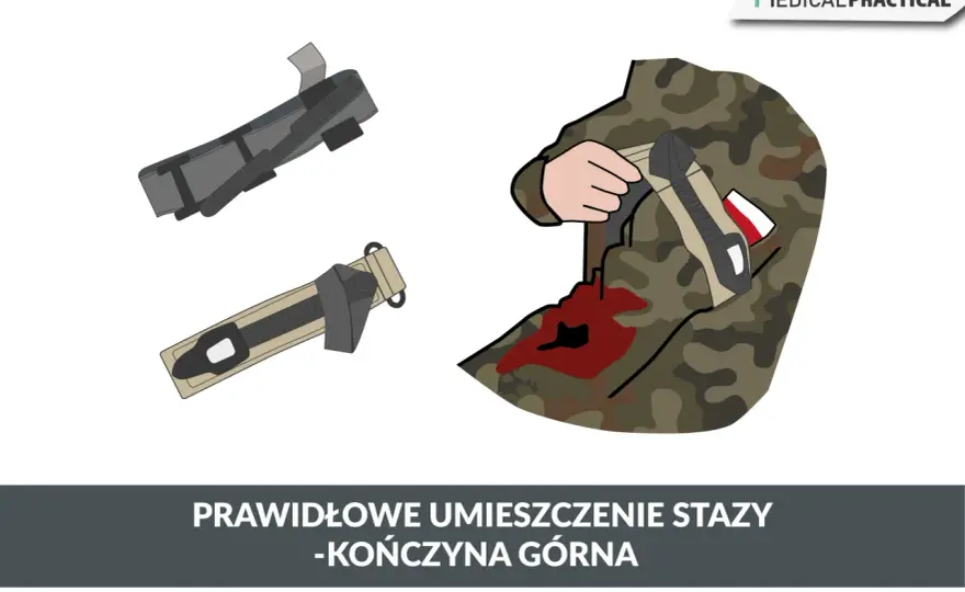 Staza w survivalu - kiedy i jak poprawnie używać?