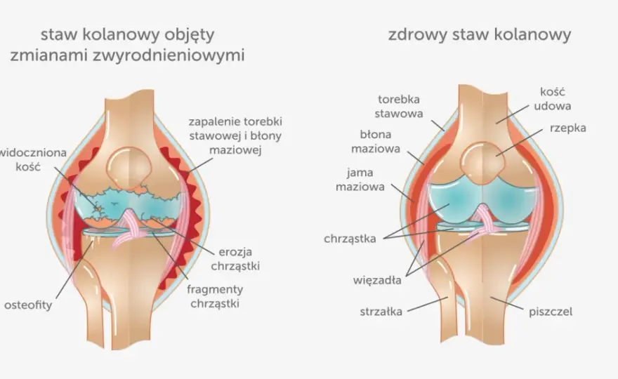 Ból kolan do jakiego lekarza? Sprawdź, kogo potrzebujesz!
