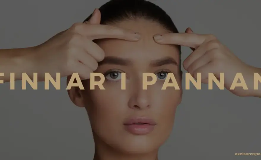 Finnar i pannan - Bli av med dem och få lugn hud
