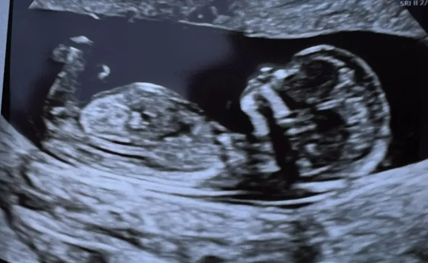 Ecografia 14 settimane - Sesso fetale: è affidabile?