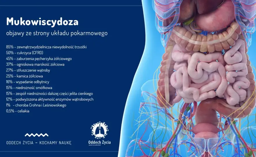 Mukowiscydoza objawy u dorosłego - co musisz wiedzieć, aby pomóc