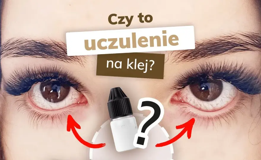 Alergia na klej do rzęs: Objawy, leczenie i co robić krok po kroku